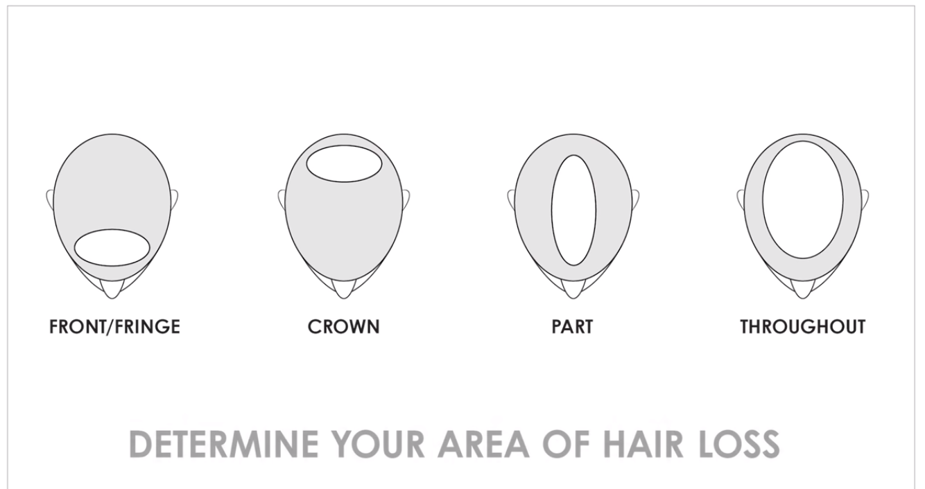 Hair Topper 101 - Choose the Right Base Size