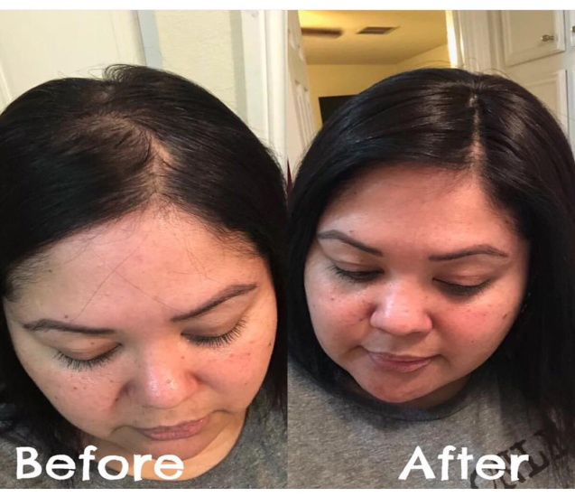 hair topper before and after