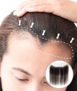 1.5” X 11” FULL LACE HAND-TIED FRONT HAIRLINE COVER-UP HAIR PATCHES |NO SURGICAL SOLUTION FOR RECEDING HAIRLINE