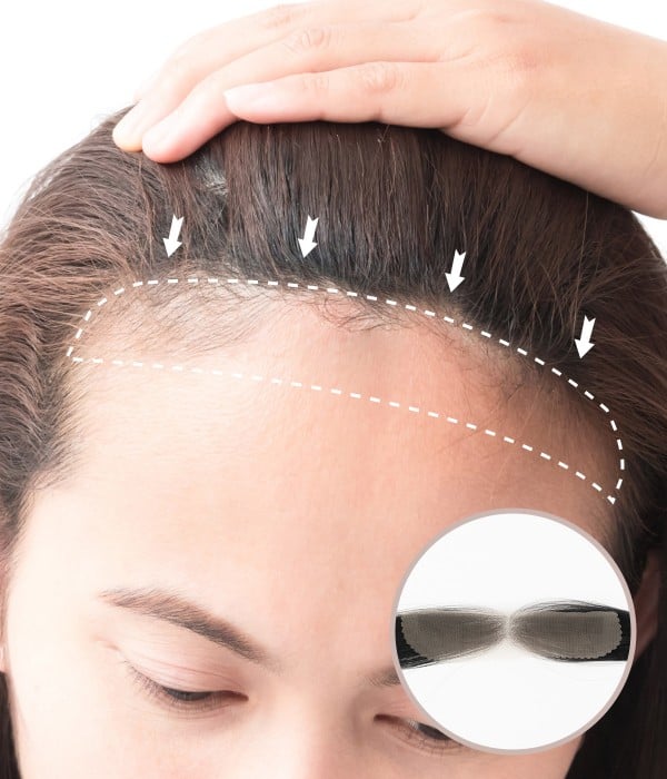 0.75” X 6.25” FULL LACE HAND-TIED FRONT HAIRLINE COVER-UP HUMAN HAIR PATCHES |NO SURGICAL SOLUTION FOR RECEDING HAIRLINE | 10"