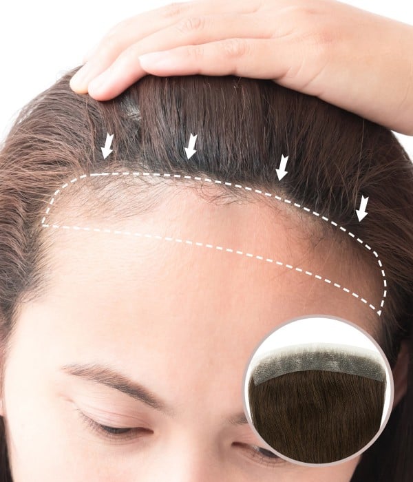0.75” X 6.25” FULL SKIN HAND-TIED FRONT HAIRLINE COVER-UP HUMAN HAIR PATCHES |NO SURGICAL SOLUTION FOR RECEDING HAIRLINE|10"
