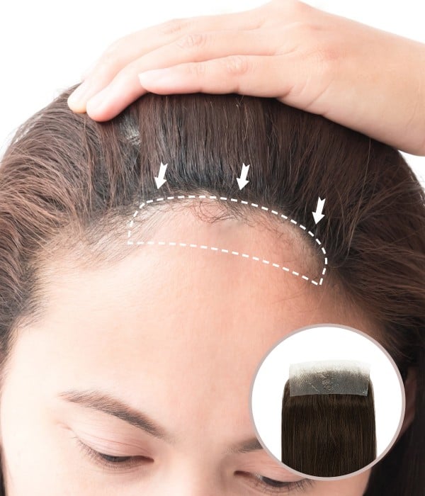 0.75" X 3" FULL SKIN HAND-TIED FRONT HAIRLINE COVER-UP HUMAN HAIR HAIR PATCHES |NO SURGICAL SOLUTION FOR RECEDING HAIRLINE |10"