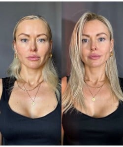 626R Vanilla Butter Blonde