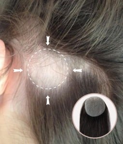 1”X 1" Full Skin Base Human Hair Cover-up Hair Patches- No Surgical Solution for Alopecia Areata |16"