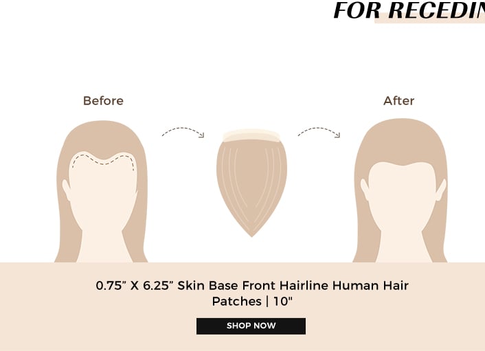 0.75X6.25 Skin Base Front Hairline Human Hair Patches | 10