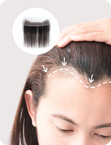 Hair Patch