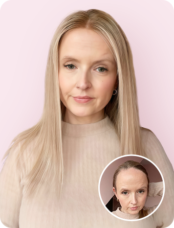 HAIRLINE TOPPER COLLECTION