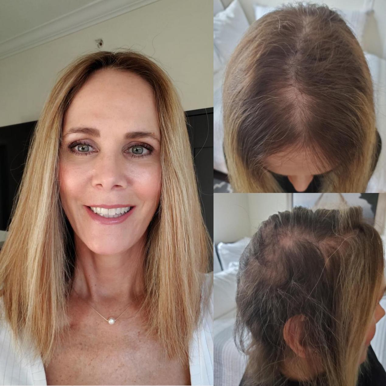 EASY WEAR HAIR CROWN TOPPERS EASY WEAR HAIR CROWN TOPPERS