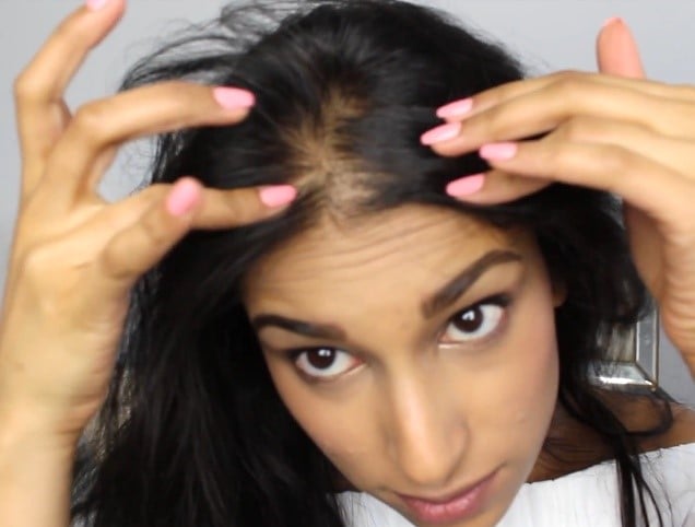 Hair Topper 101 - How to choose a Hair Topper for the Beginning Stages of Hair  Loss