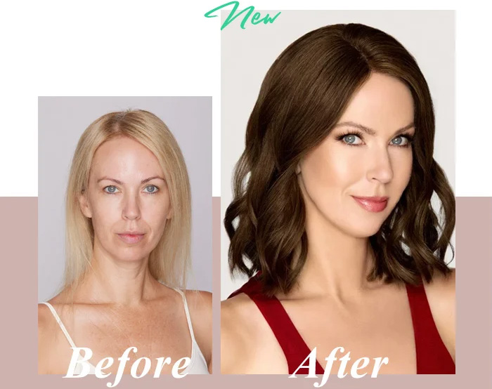 Helping women with all forms of hair loss