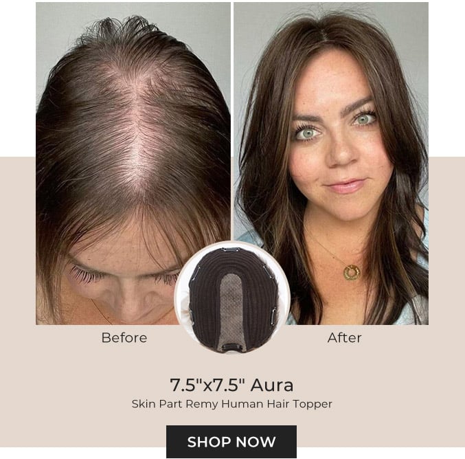 7.5”X7.5” Aura | Skin Part | Left Part Remy Human Hair Topper