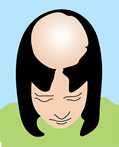 hair loss